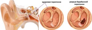 Лопнет ли барабанная перепонка, если прослушивать песни синего кита вблизи?