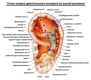 Кто подтолкнул Nogier к разгадке аурикулярной соматотопии?