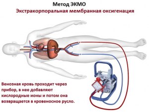 Сухое кровопускание в медицине что это?