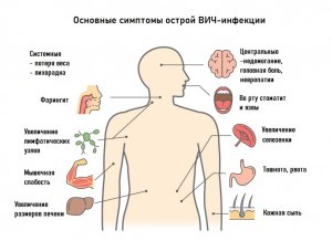 Заражена ли лимфа при ВИЧ инфекции?