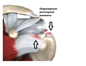 Что означает ротация плечевого сустава?