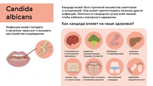 Как часто может повторяться молочница?