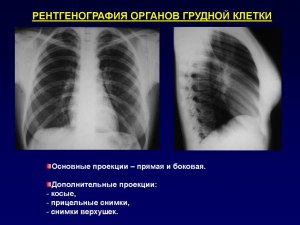 Удар пришелся по ребрам,без рентгена как установить диагноз?