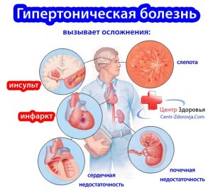 Может ли гипертоническая болезнь возникнуть на фоне нервничаний?