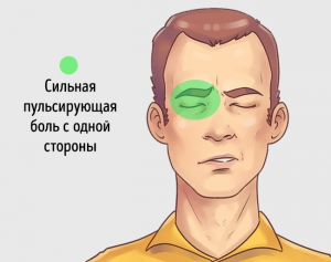 Почему в РФ не уделяется внимание исследованию кластерной головной боли?