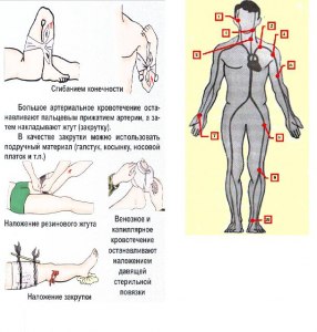 ОГЭ Биология, Как ответить на вопрос о наружном кровотечении у человека?