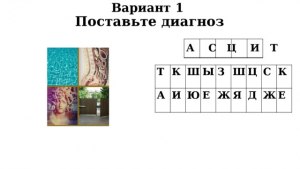 Почему слово "диагноз" пишется через "з", а слово "диагностика" через "с"?